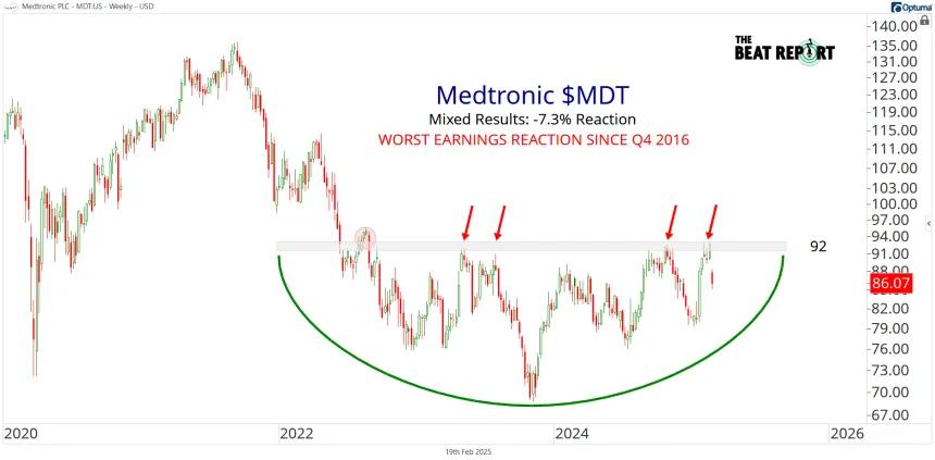 MDT Chart (02.19.2025)